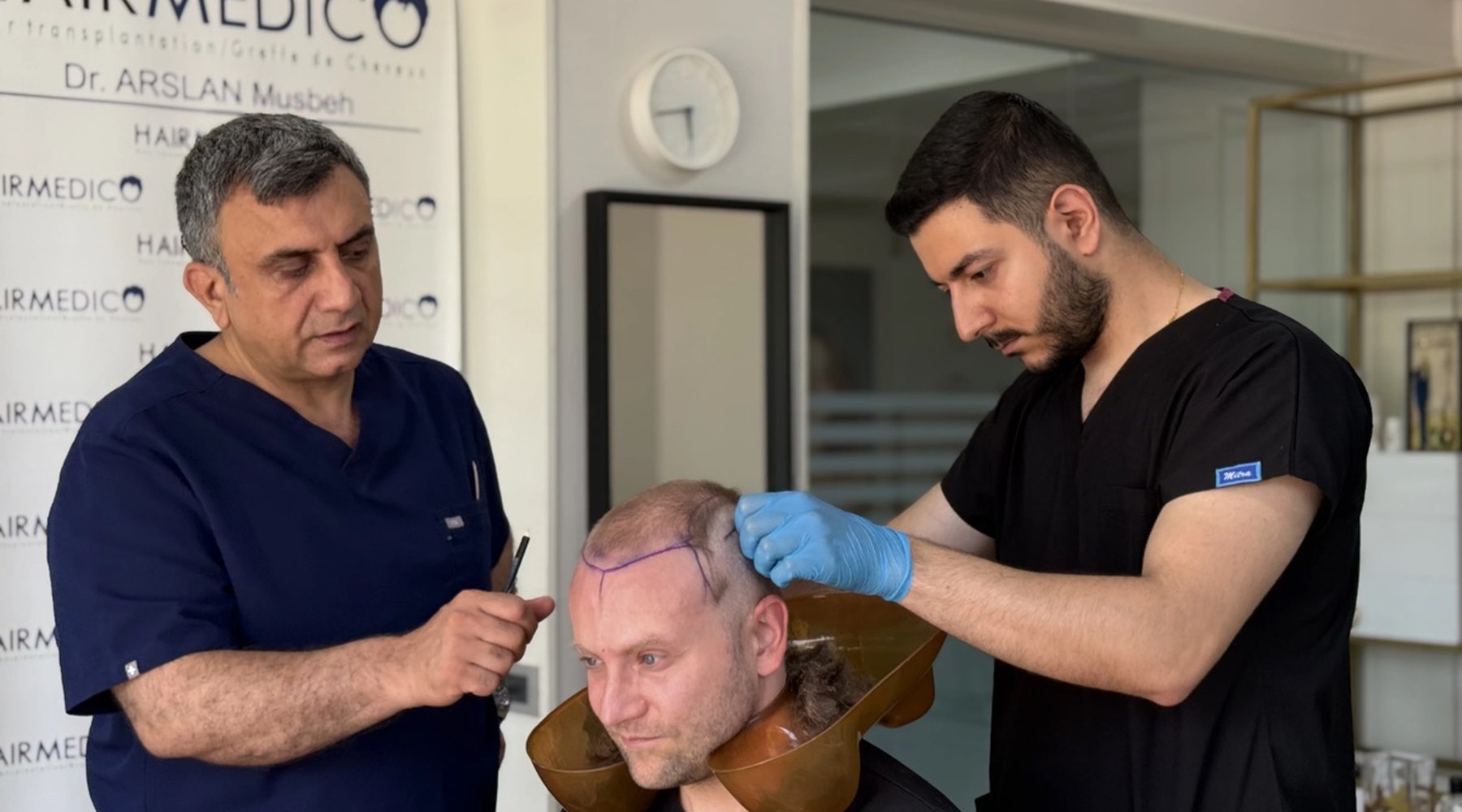 AI hair transplant prediction and simulation tools in use