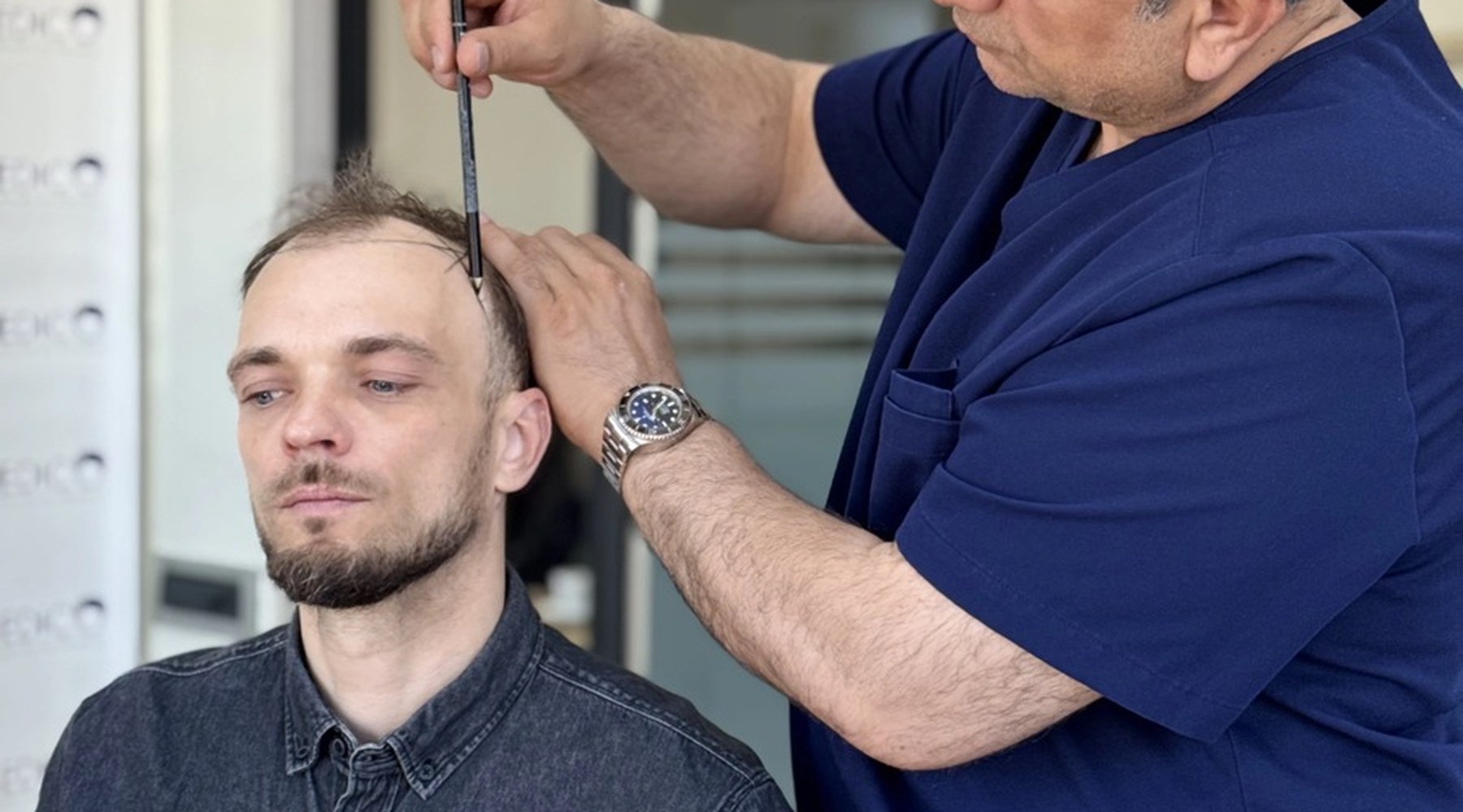 Digital technology and AI in modern hair transplant planning