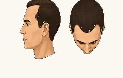 II