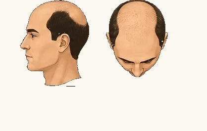 Va