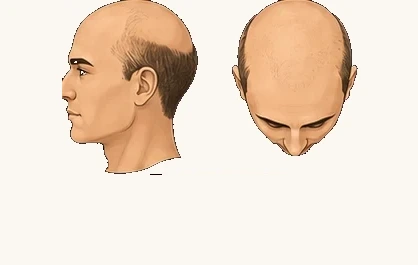 VII